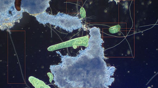 Microscopy image after Nymph analysis